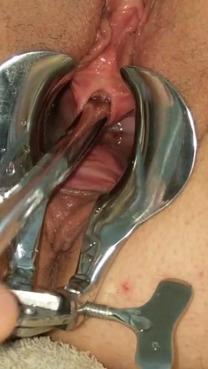 Female Urethral Sounding