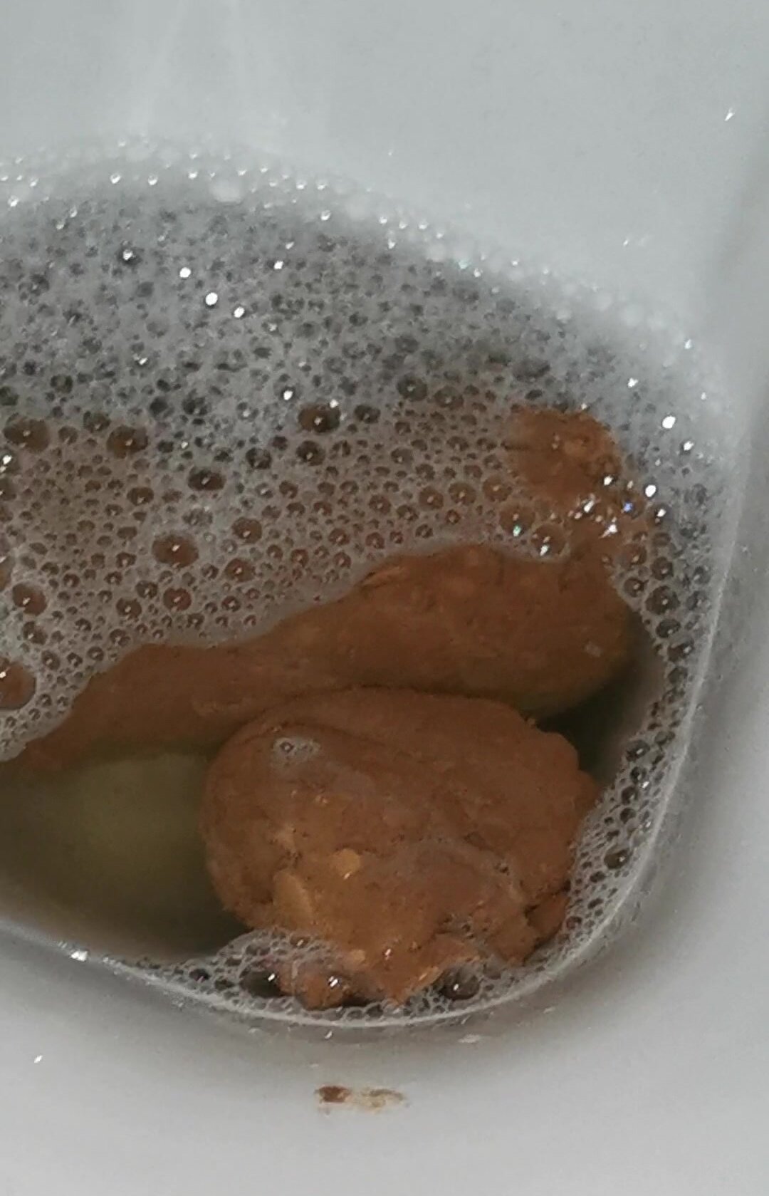 Constipated poop after giving birth in 08/20