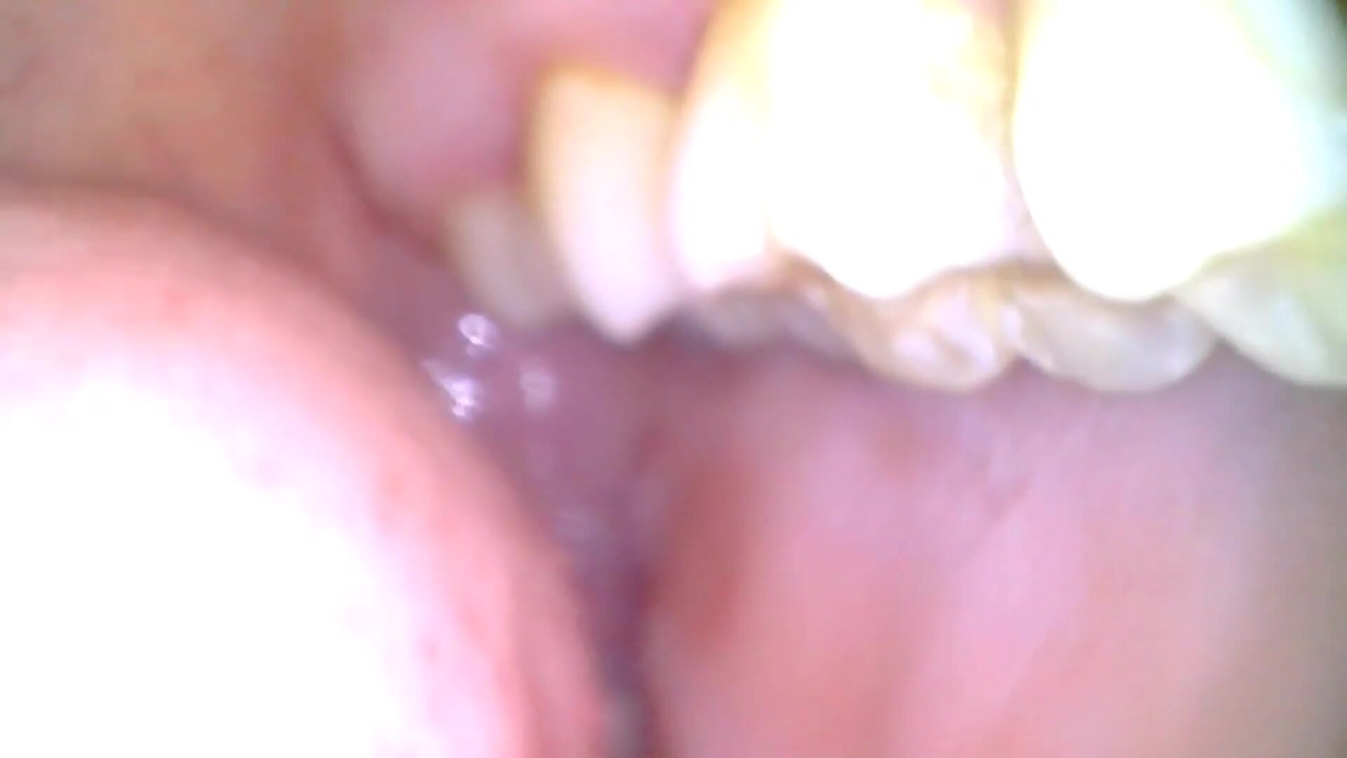 girl mouthcam Endoscope - video 2