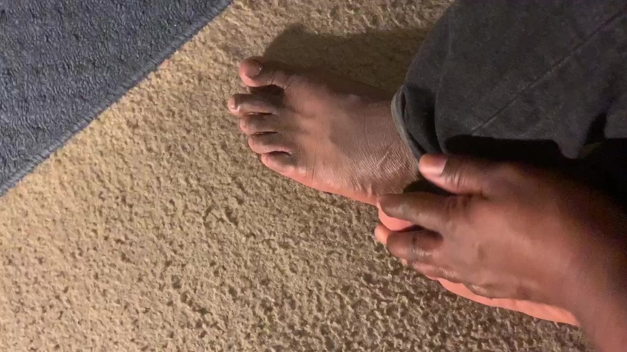 Part 2 of sweaty feet