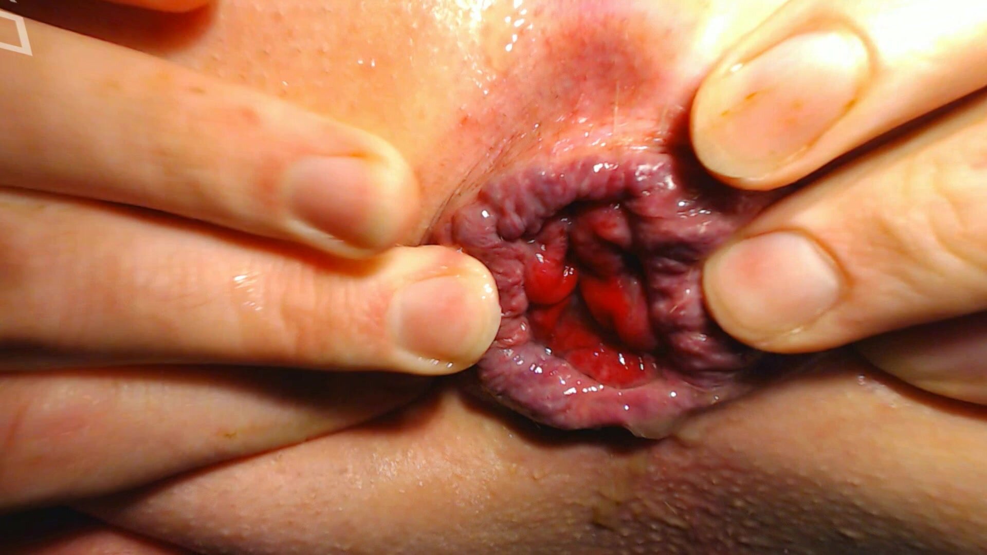 fingering my butthole 1 closeup
