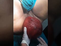 Monster Anal Prolapse