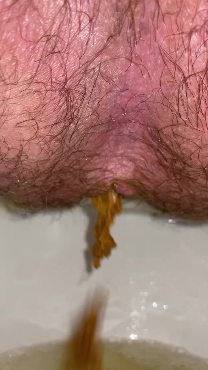 Fart and shit toilet cam