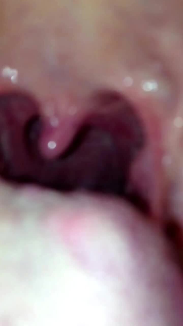 Throat and Uvula