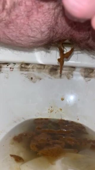 Rank Diarrhea from a Hairy Asshole
