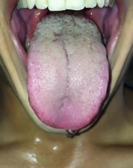 MOUTH, VORE AND TONGUE, Giant 13