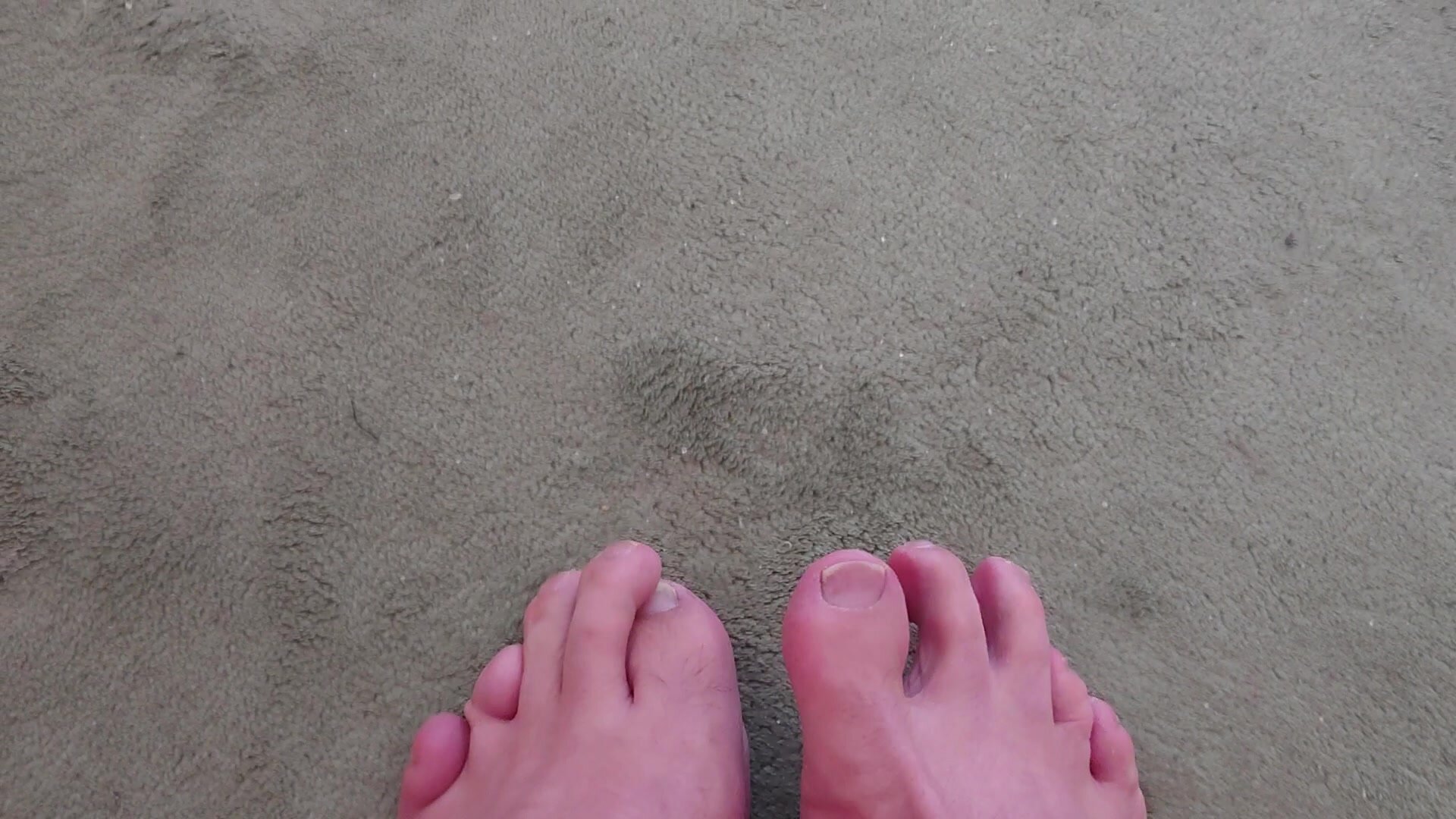 Please comment my deformed toes