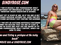 Extreme anal fisting & prolapse at the rocky beach