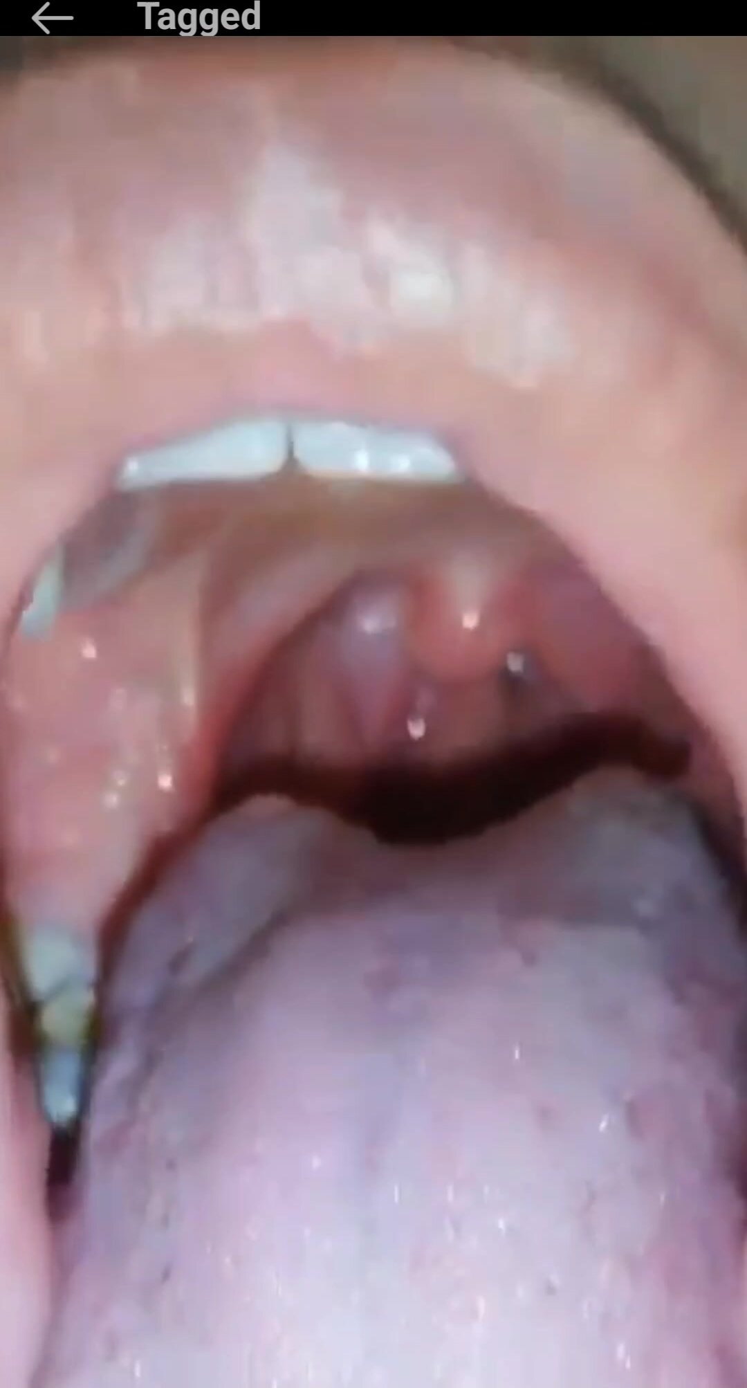 Columbian mouth