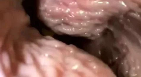 Sex and orgasm from inside the vagina fetish porn at ThisVid tube