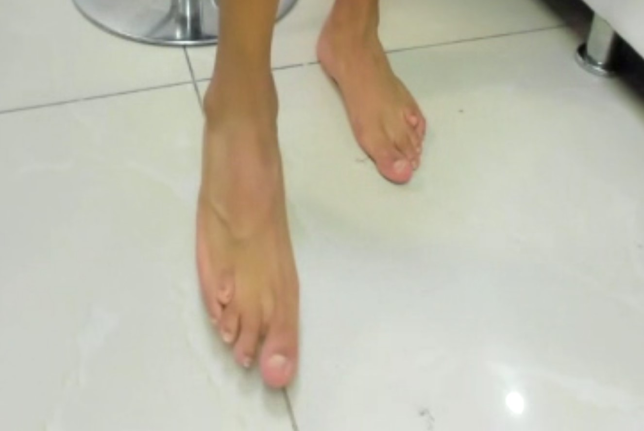 Genetically Different Toes