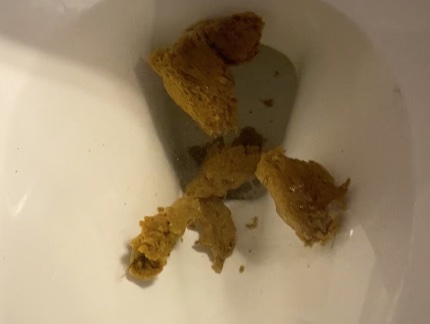 Turds Away with Extra Chunks