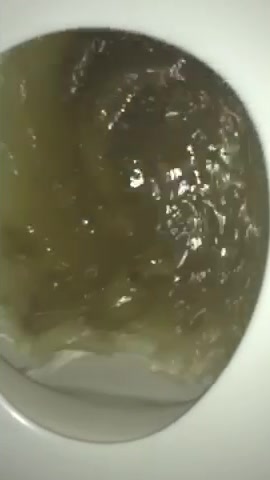 Mushy black bean poop flushing
