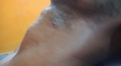 Adam’s apple massage - video 245