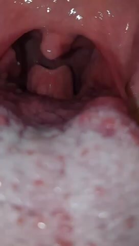 A little uvula play