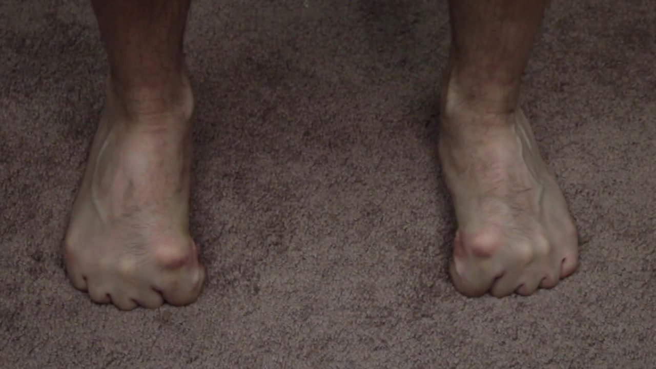 Flexible toe curling