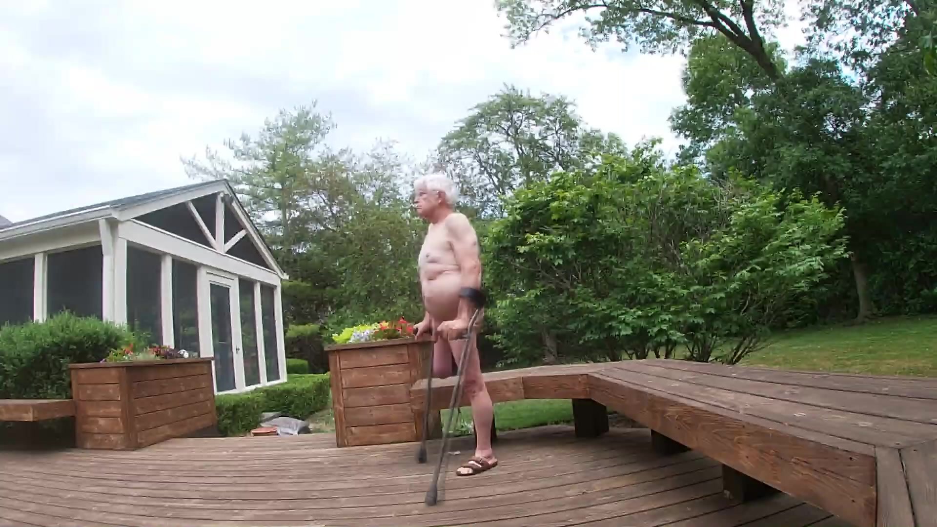 Deformed Polio Disabled Man Shows Naked Body Outdoors