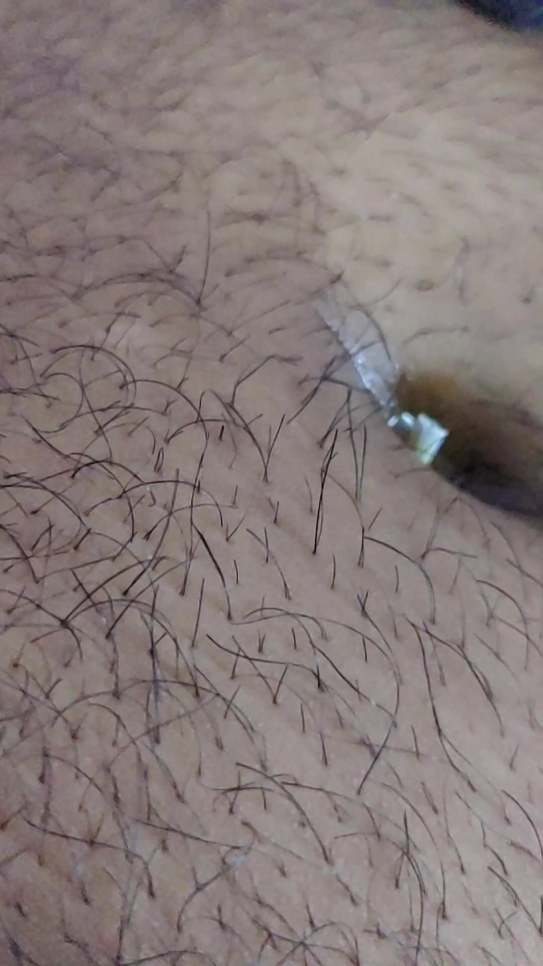 Wire moving in my navel