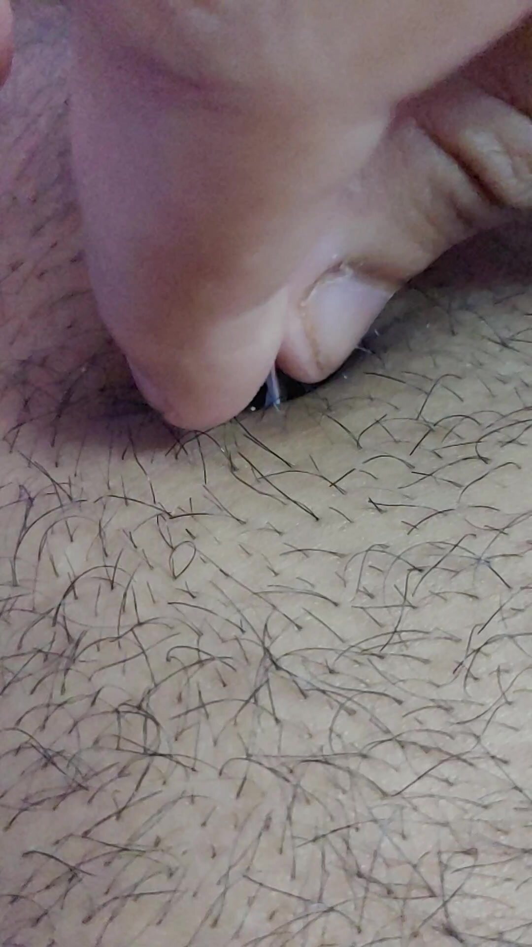 Removing wire from navel