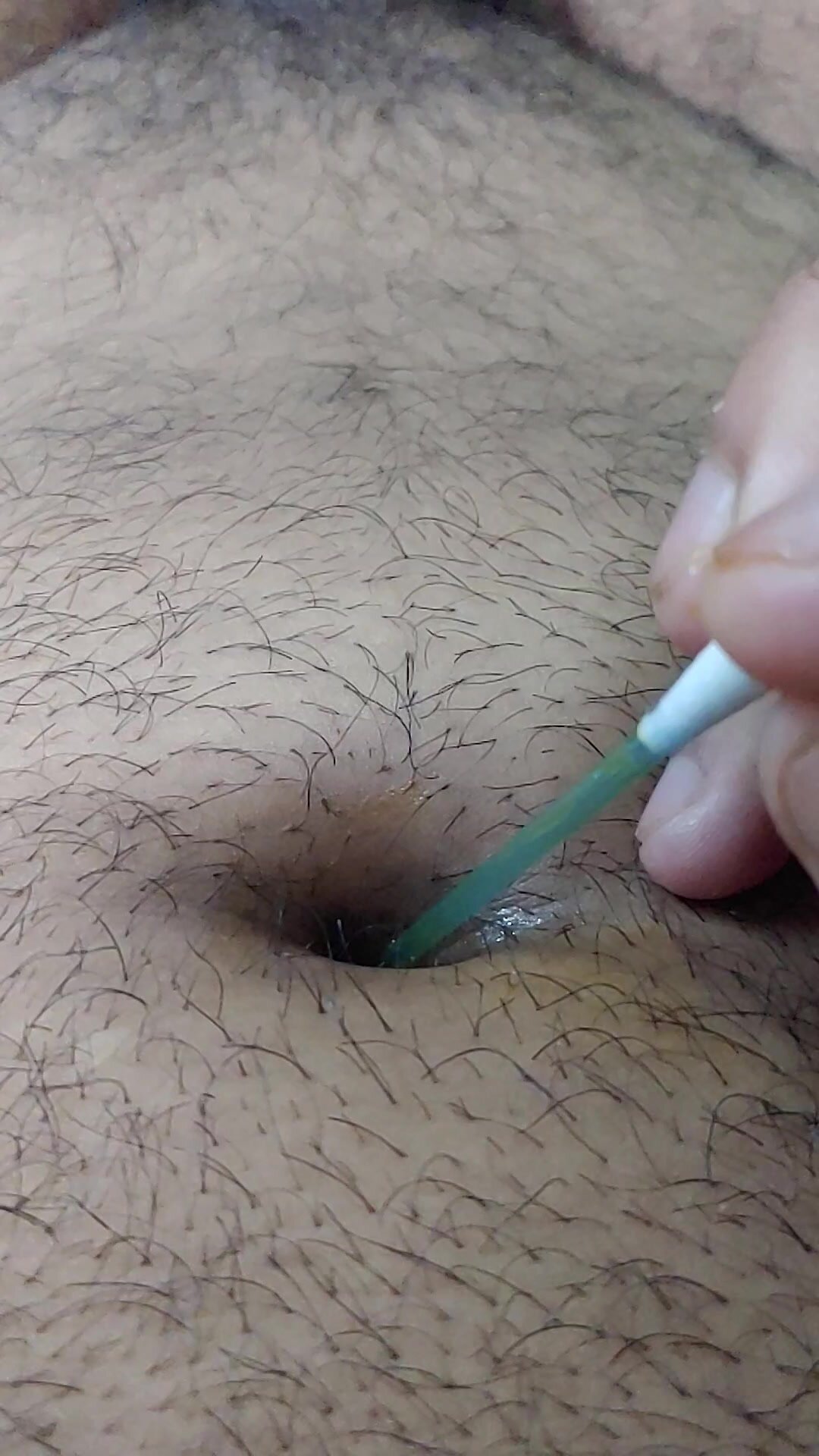 Inserting Q tip in my navel