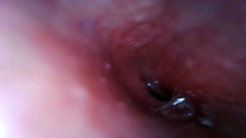 my girlfriend's esophagus