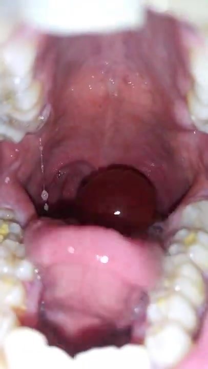 Swallowing grapes whole