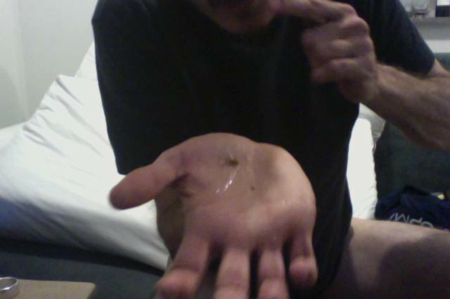 comendo catarro