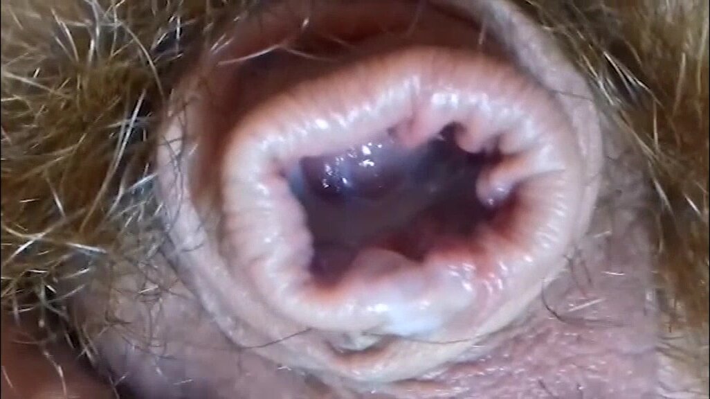 load  into gaped foreskin of lil cock sleeped