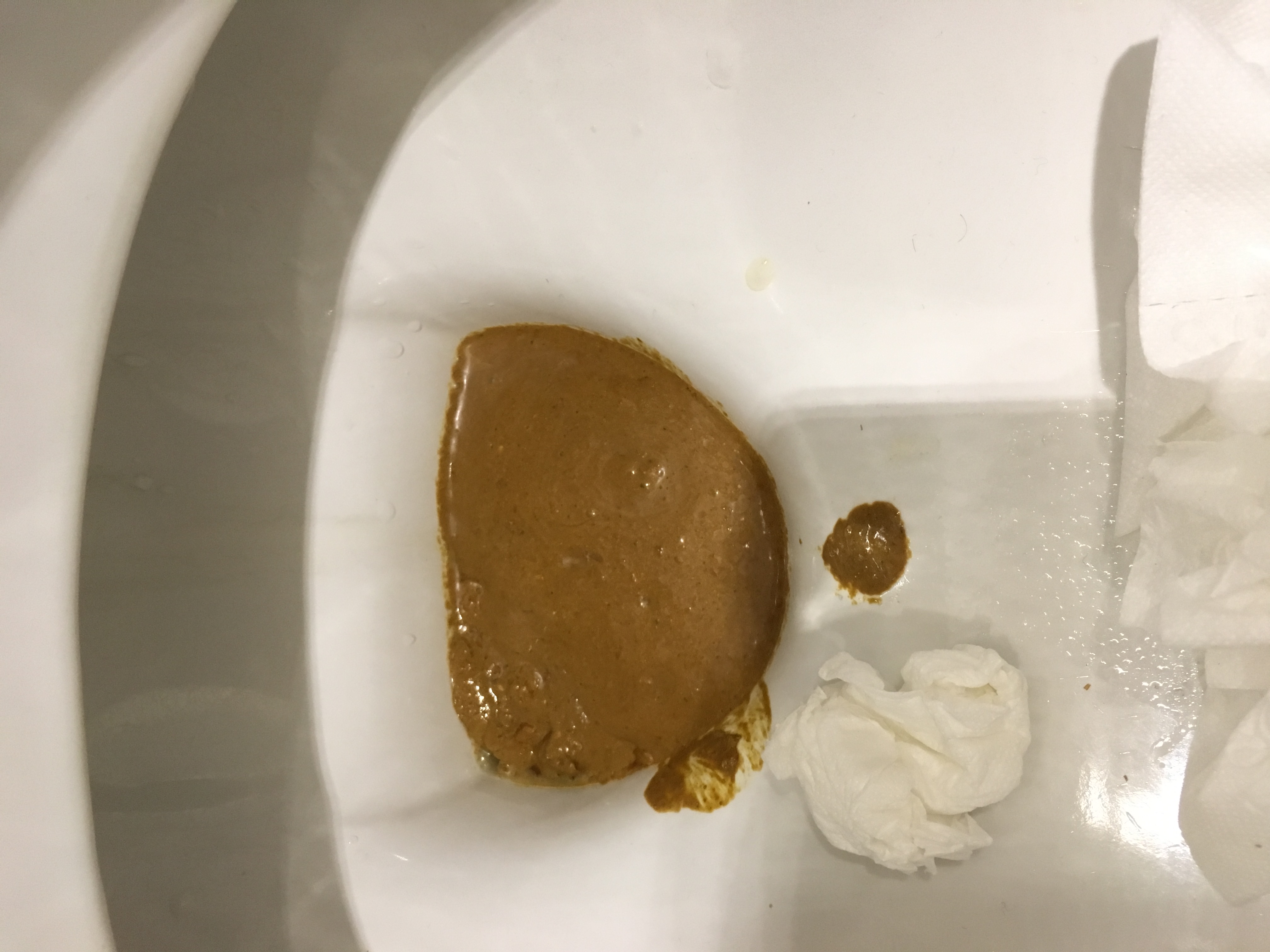 runny and noisy shit at work 11/21/2017