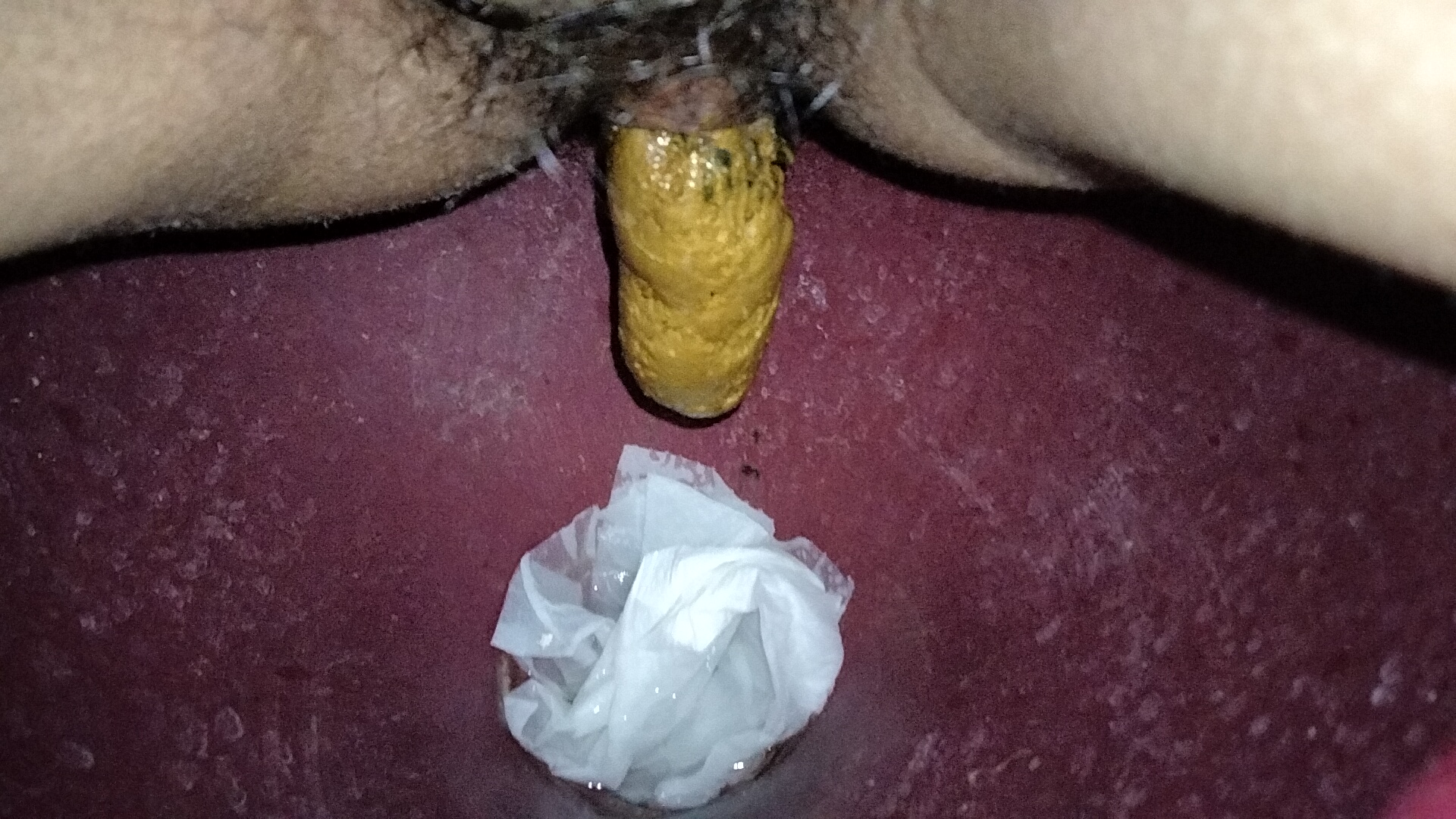 yellow black ball poop