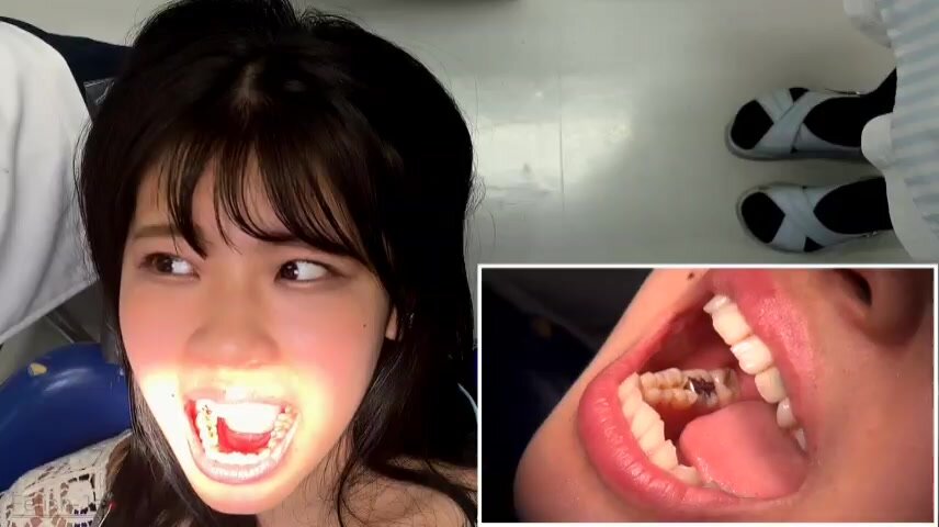 Hottest dental stuff - ThisVid.com