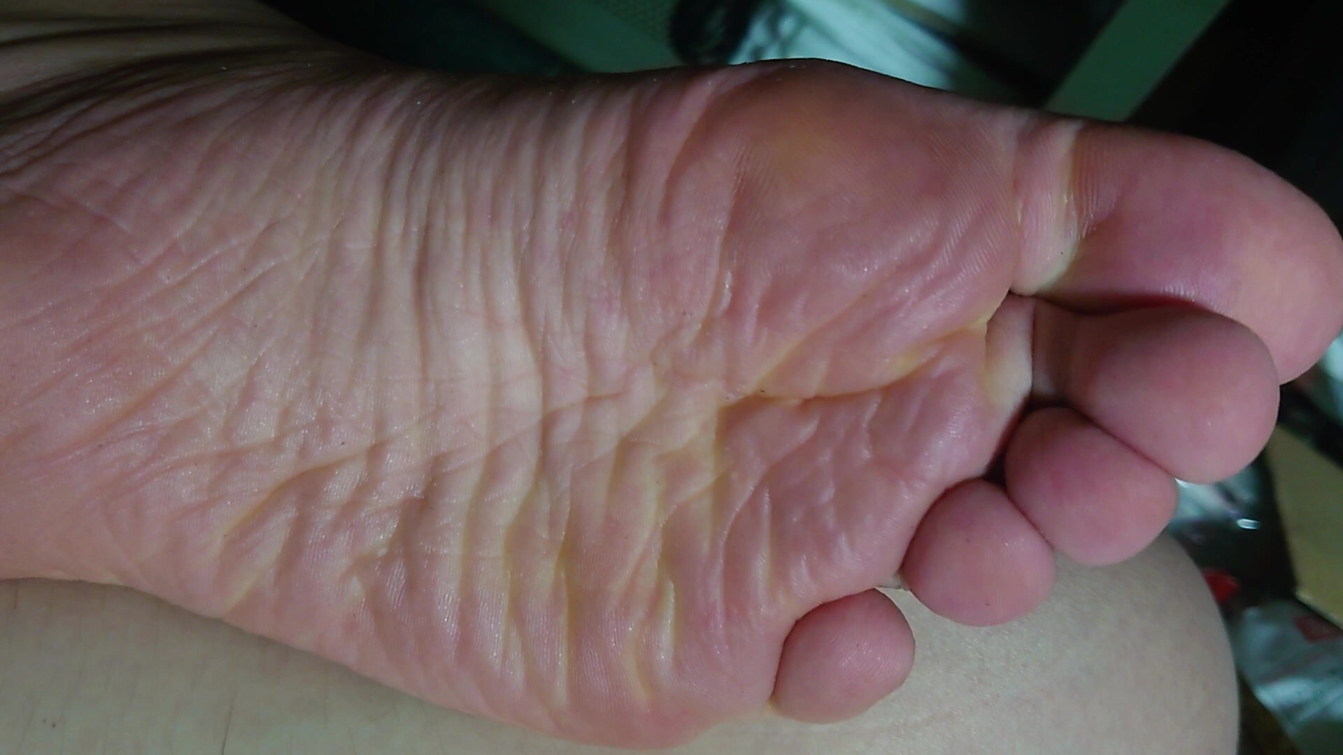 sweatyfeet
