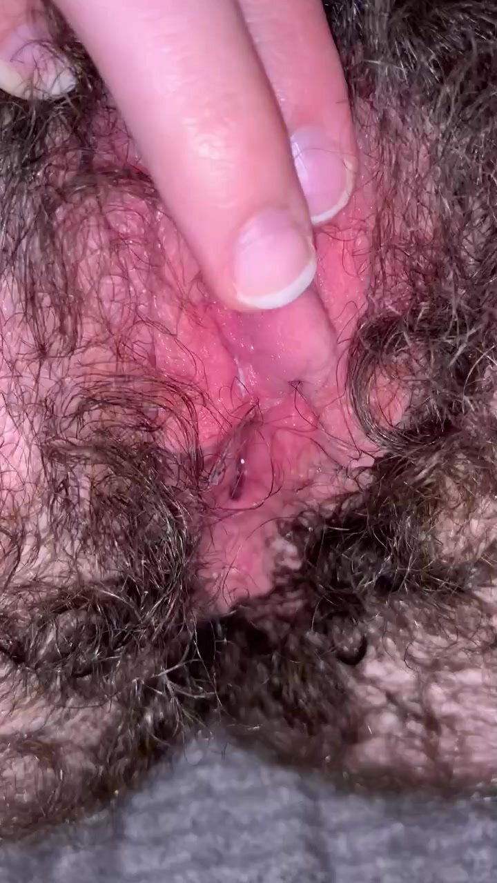 Hairy FTM Trans Male Shows Off Big Clit and Vag