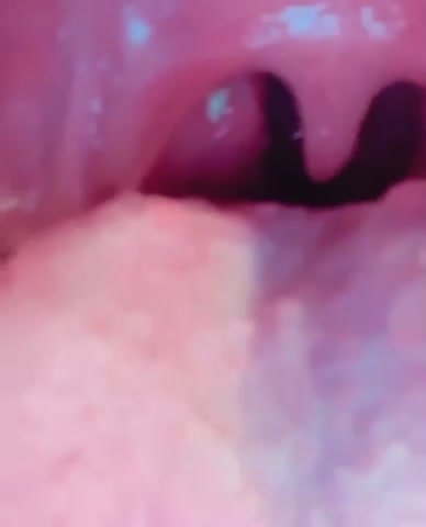 Instagram Uvula and Tonsils