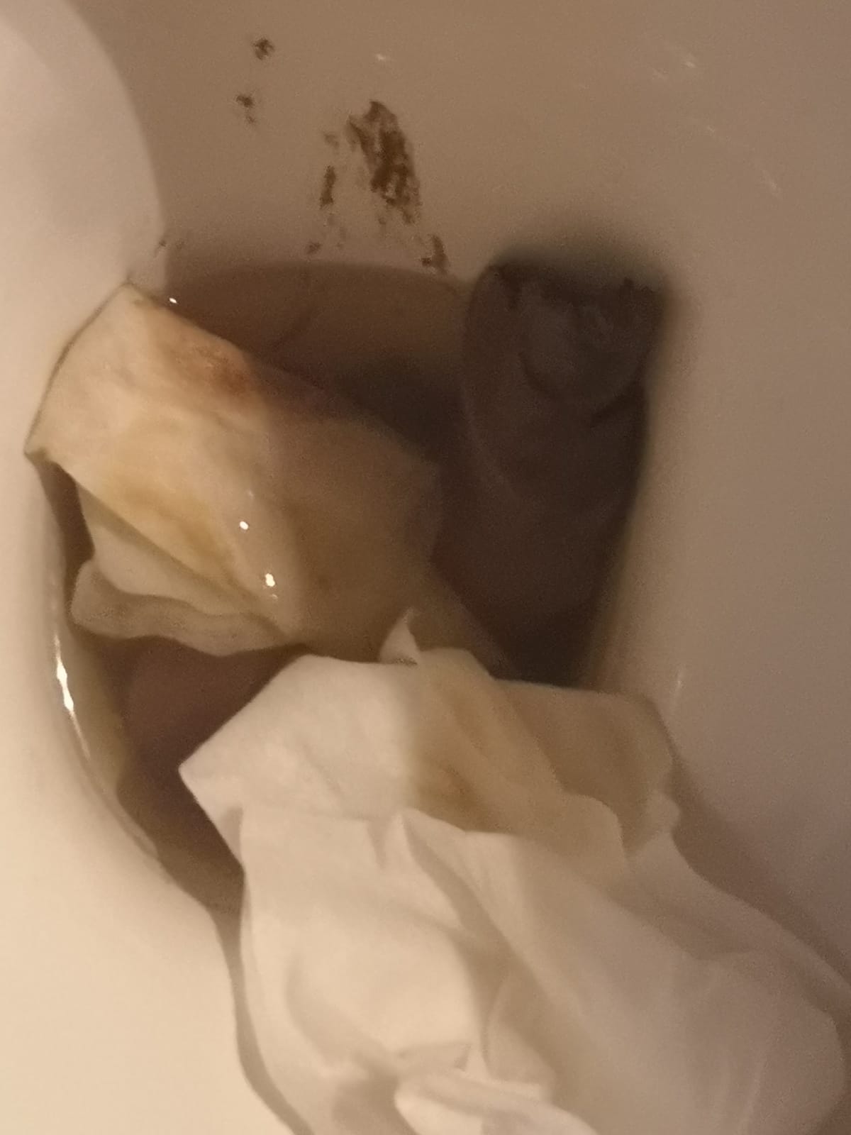 My girlfriend poop after 3 days