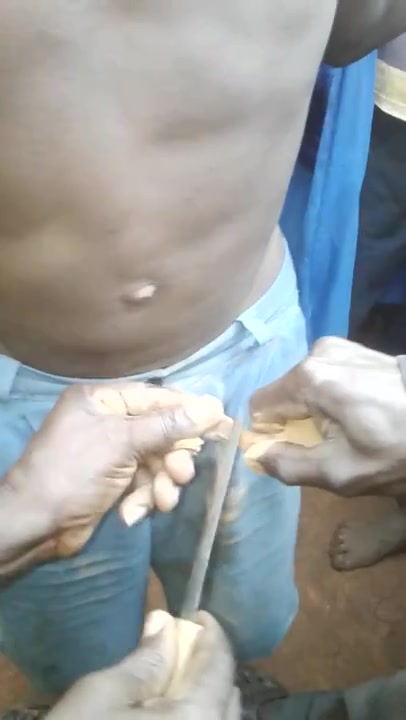 Public Circumcision 1