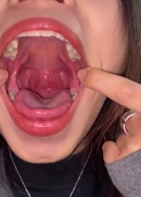 Chinese mouth 13