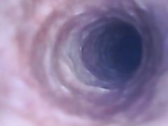 Tiny inside urethra