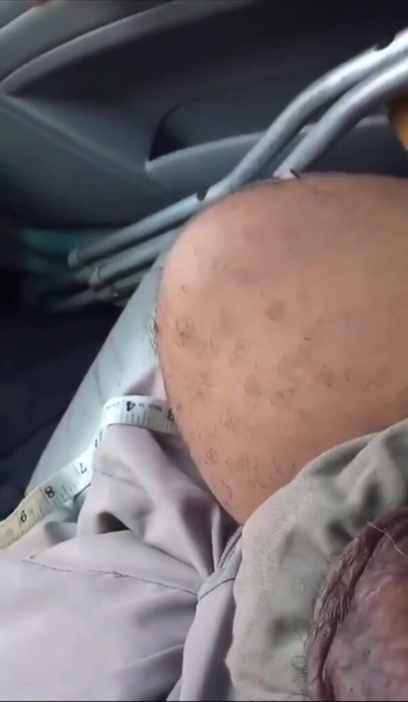Hot amputee - video 3