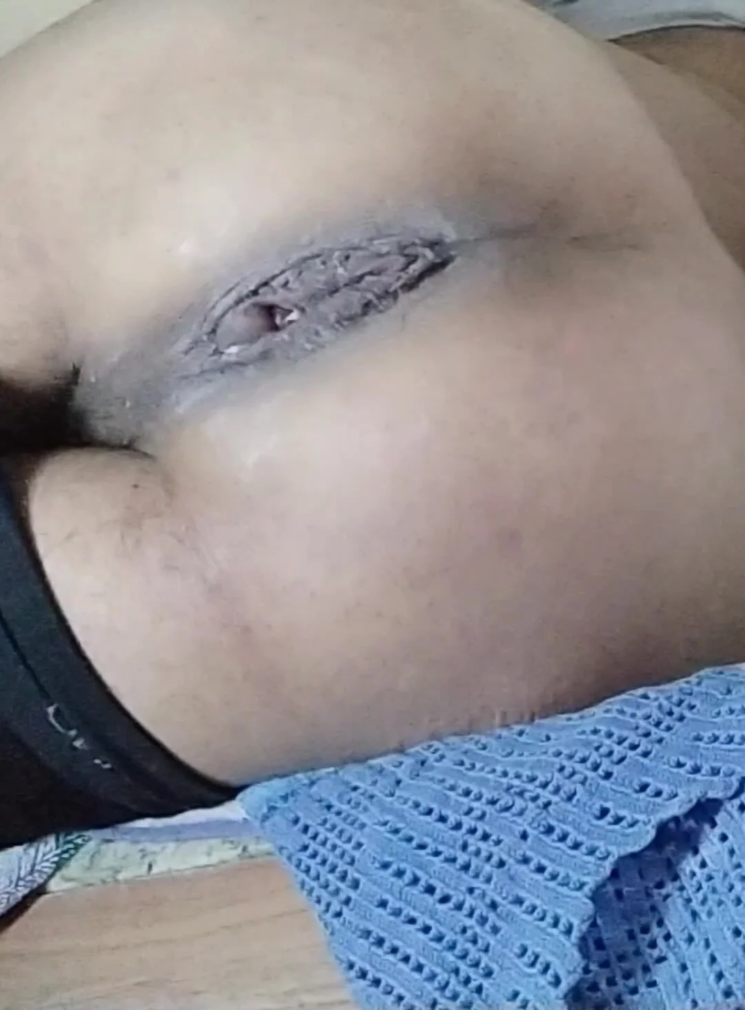 Extreme Amateur Anal