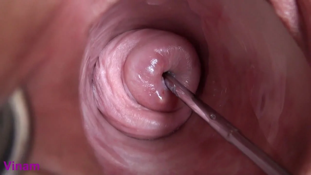 Cervix insertion porn