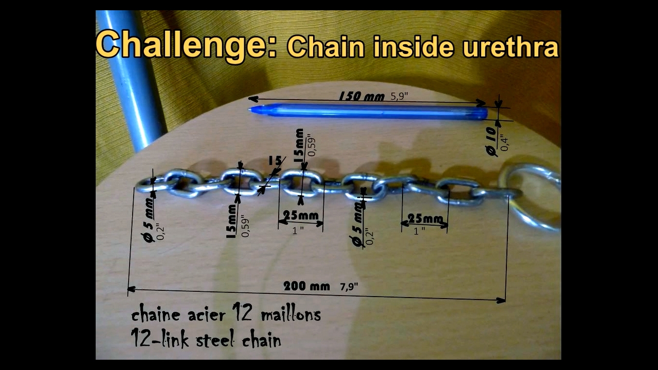 Challenge: Steel chain in urethra