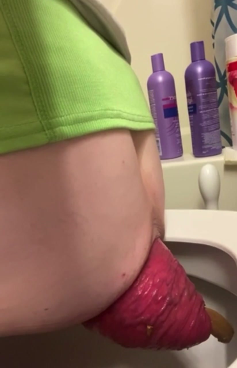 Woman with Huge Prolapse Pooping