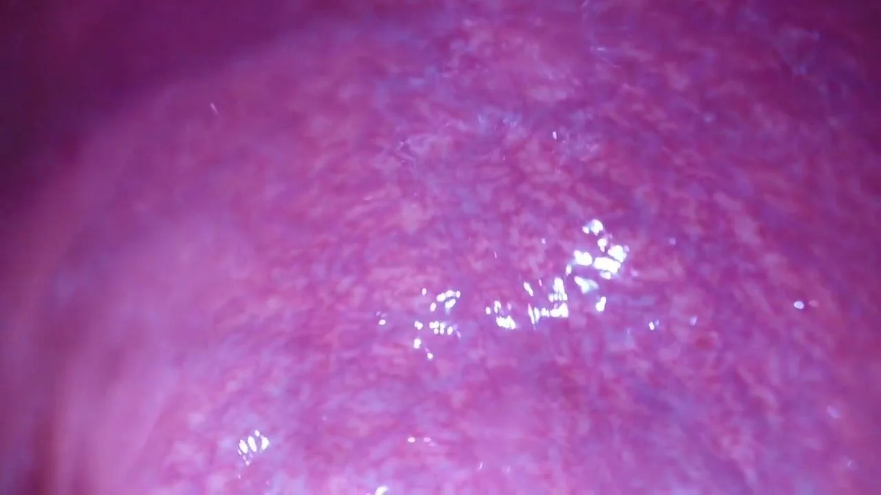 Pov inside an rectum facing asshole - ThisVid.com