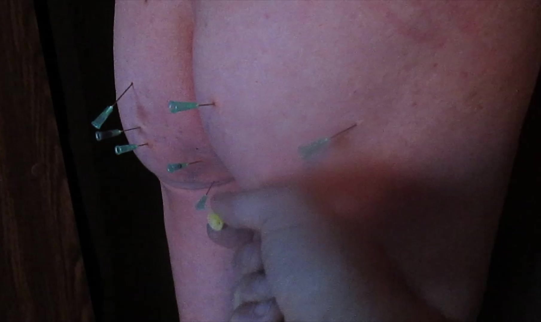 Taking out the needles of the bIeeding ass of My slave