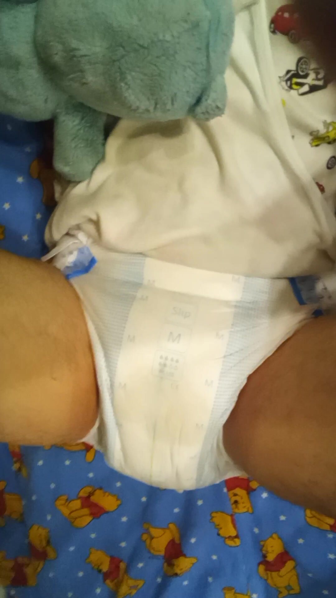 Babyboy opens poopy diaper