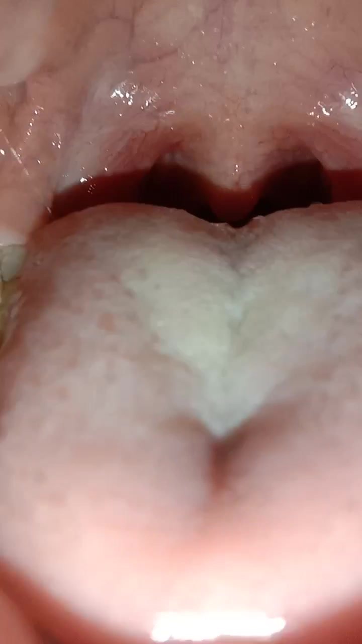 Chinese girl throat view