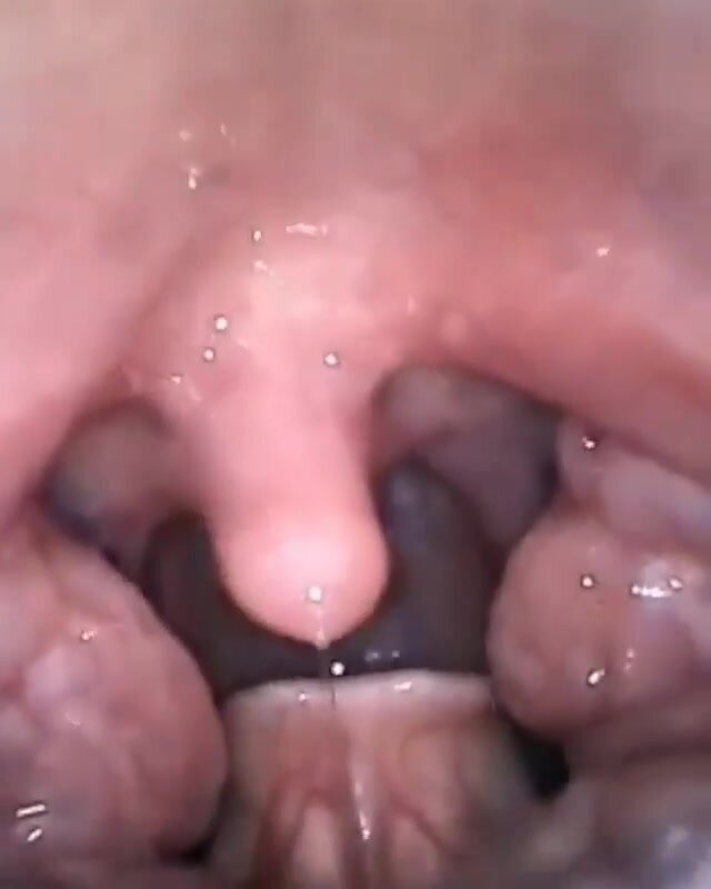 short throat view