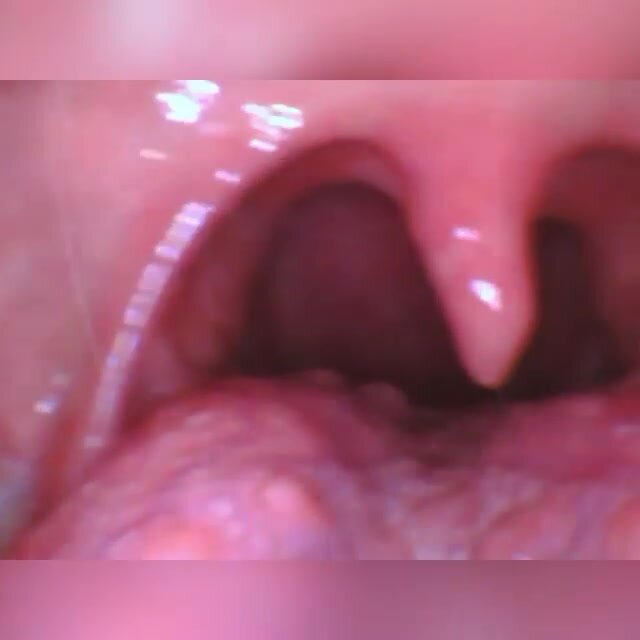 American girl endoscope