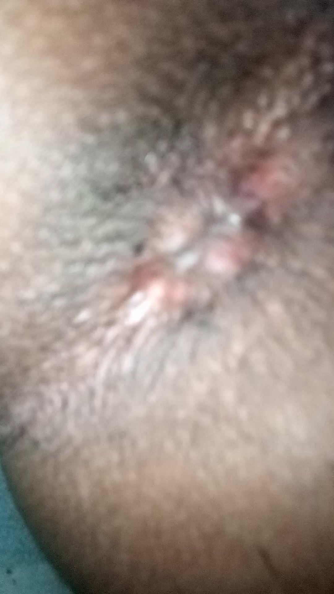 bottom asshole
